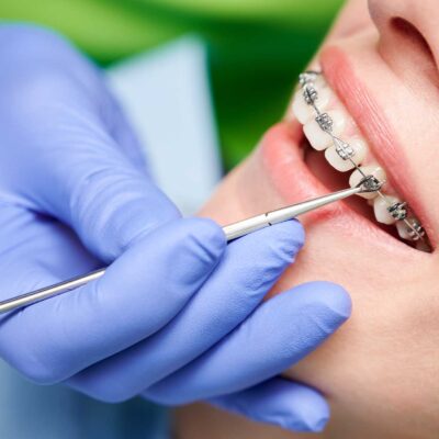 Orthodontics